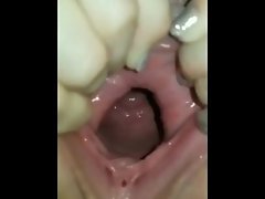 vaginal examination from the inside